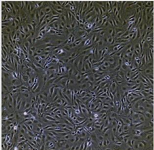 人脐静脉内皮细胞,huvecp细胞